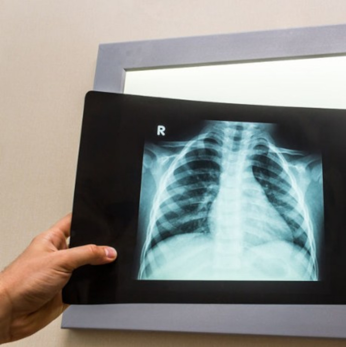 Čáslav, Plicní ambulance - foto 3